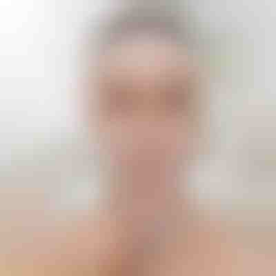 Zdvíhací pás na tvarovanie tváre | KIMLIFT